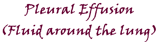 Pleural Effusion